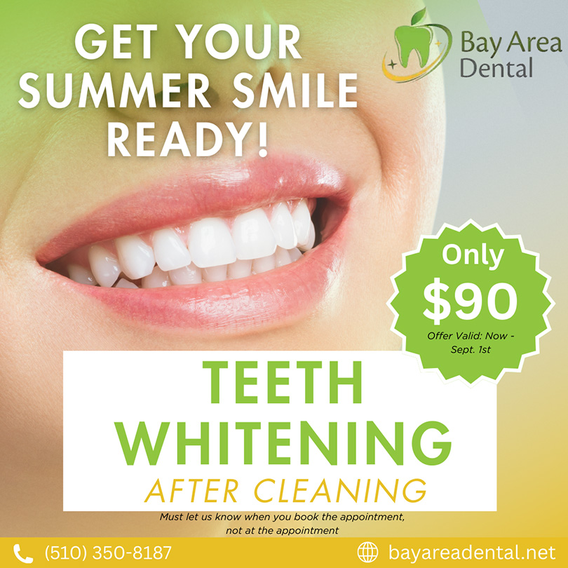 Bay Area Dental | Retainers, Crowns and Oral Cancer Screening